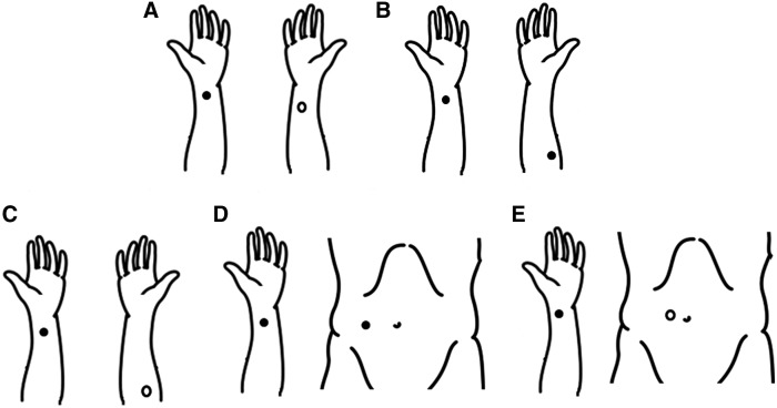 A series of hands showing acupuncture points